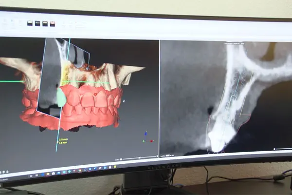 dental-technology-stillwater-oklahoma Dental technology | Oral Surgery Oklahoma | Dr. Richard Miller | Central Oklahoma Oral & Maxillofacial Surgery Associates