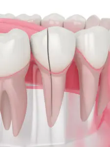 dental implants North Oklahoma