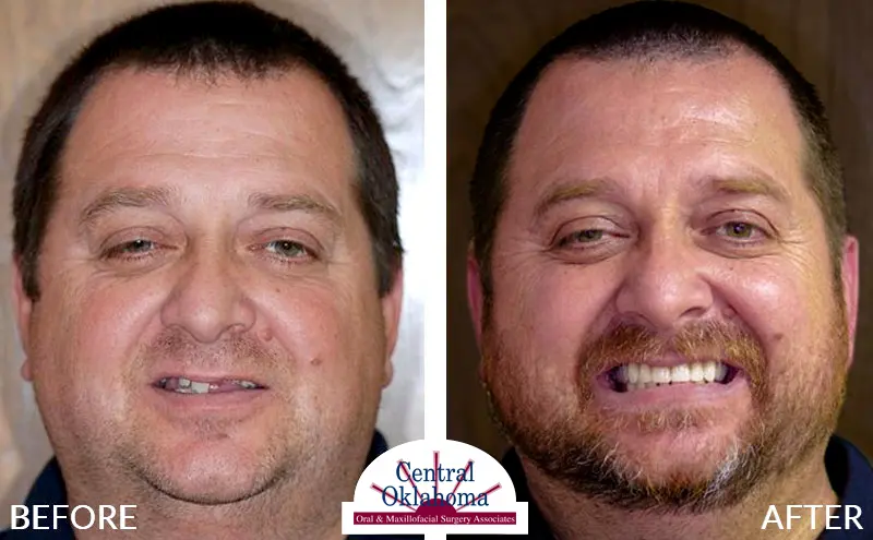 all-on-4-oklahoma-city-ok-EDIT