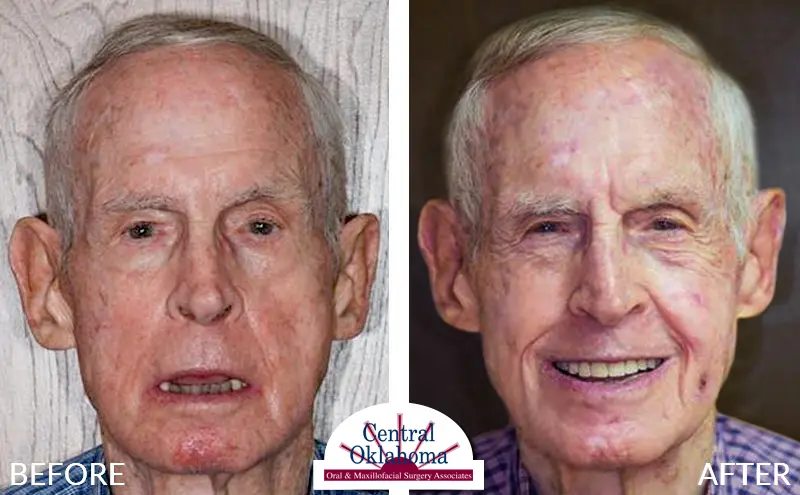 all-on-4-stillwater-ok-EDIT