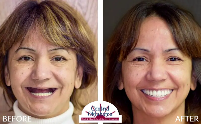 all-on-4-stillwater-oklahoma-EDIT