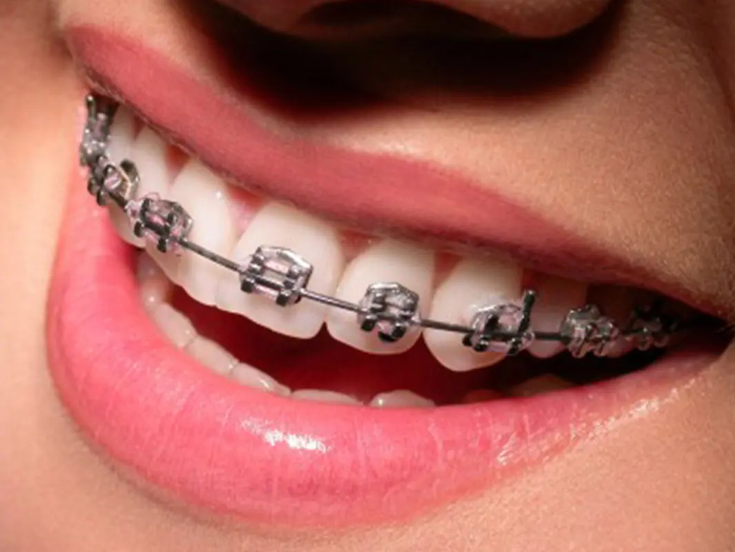 tooth extraction North Oklahoma