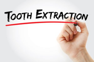 tooth extraction north Oklahoma
