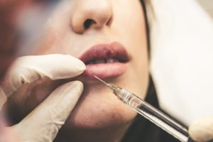 Needle being injected into a woman's lower lip